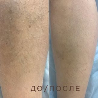 Депиляция  Армавир